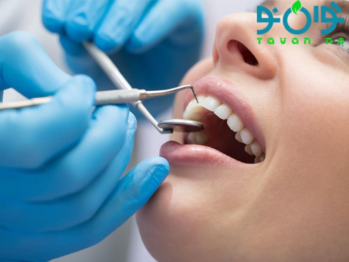 دندان پزشکی چیست؟ بررسی انواع بیماری های مهم دندان